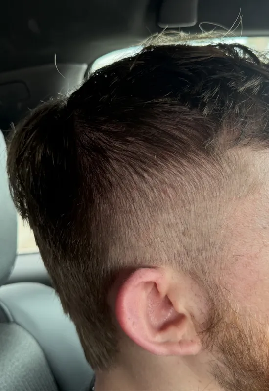 Burst fade